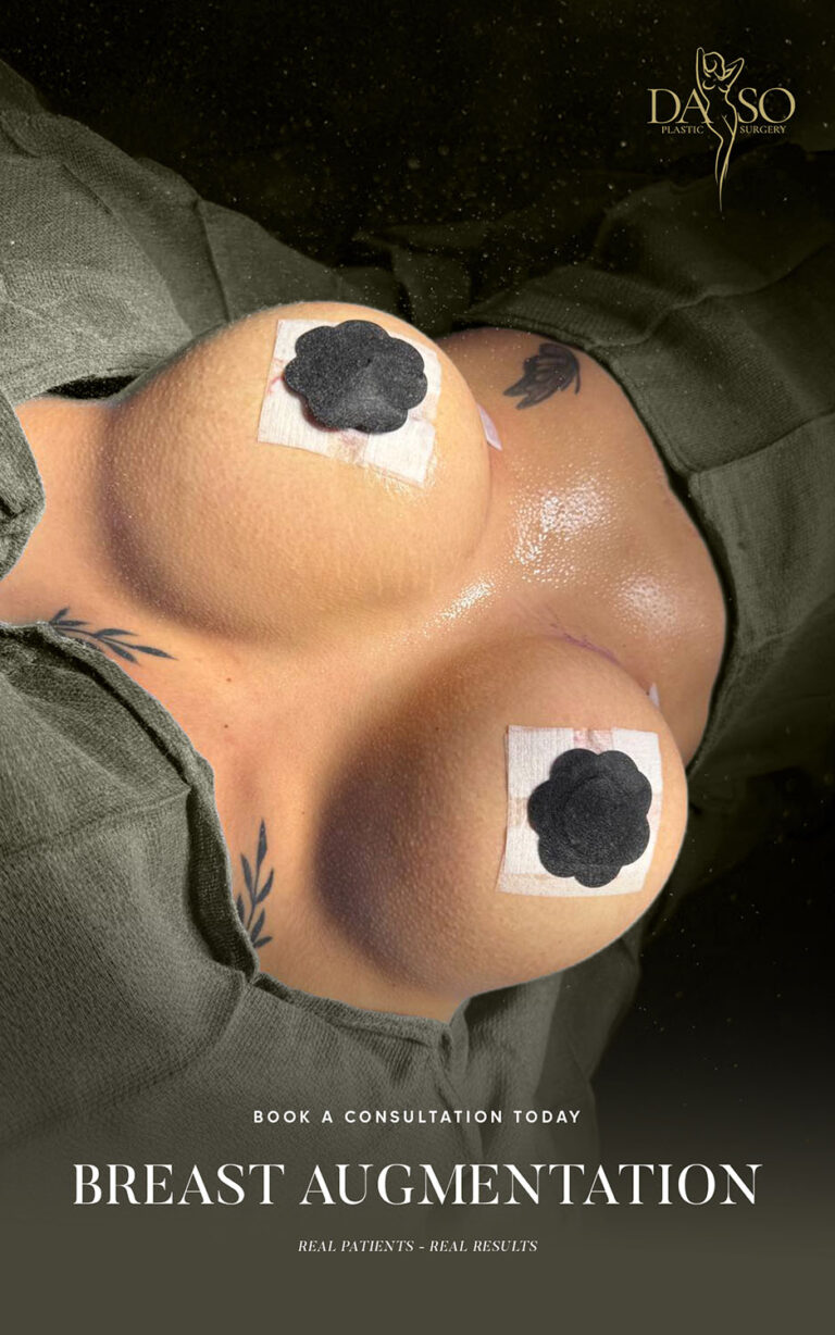 PHOTO BREAST AUG 4