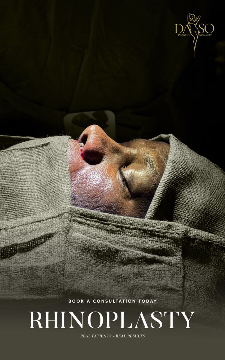 RHINO 3