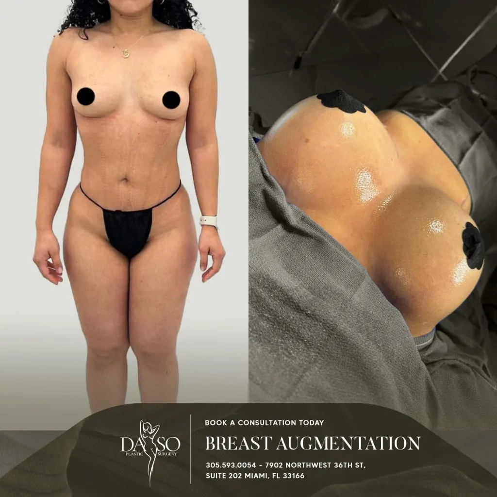 breast surgery