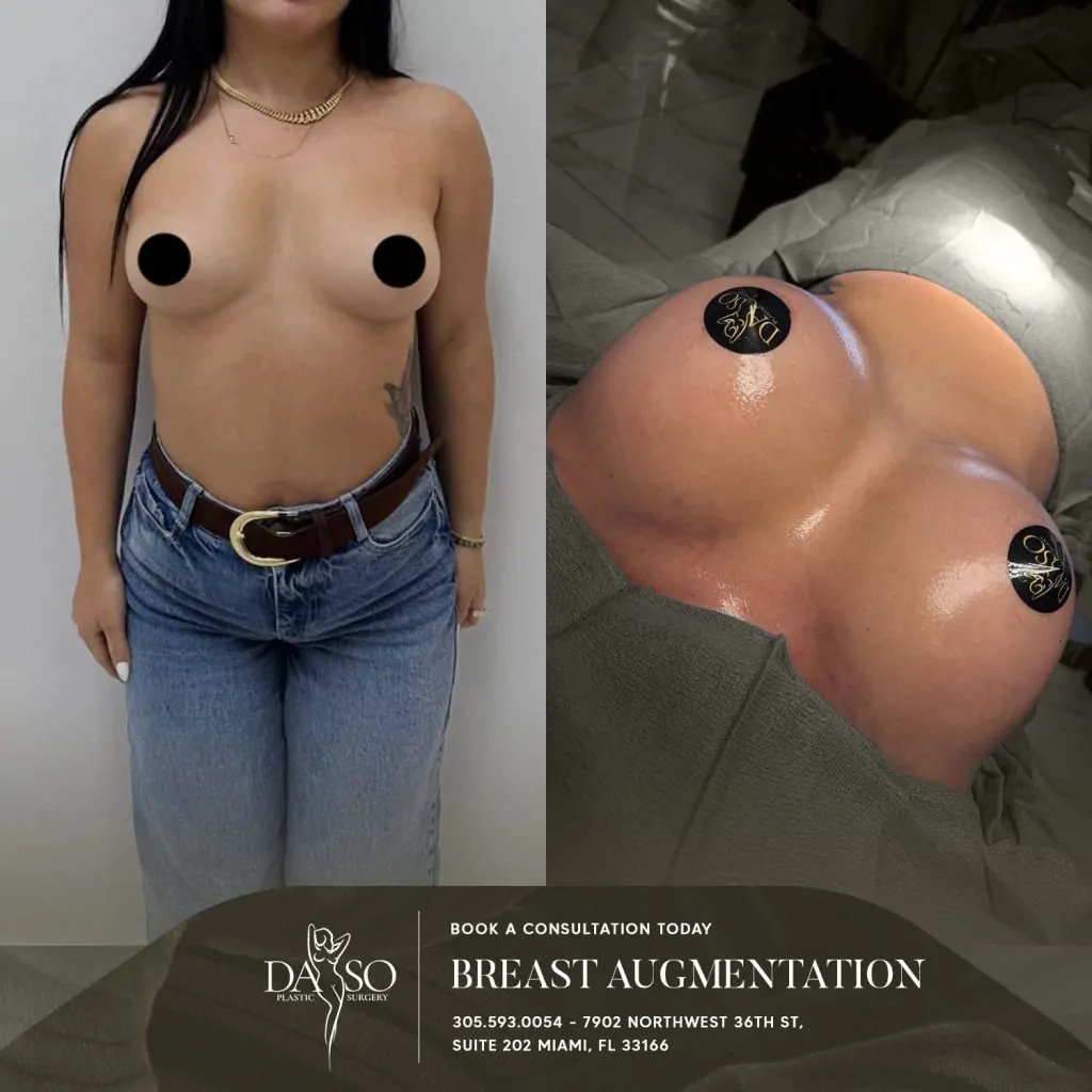 breast surgery