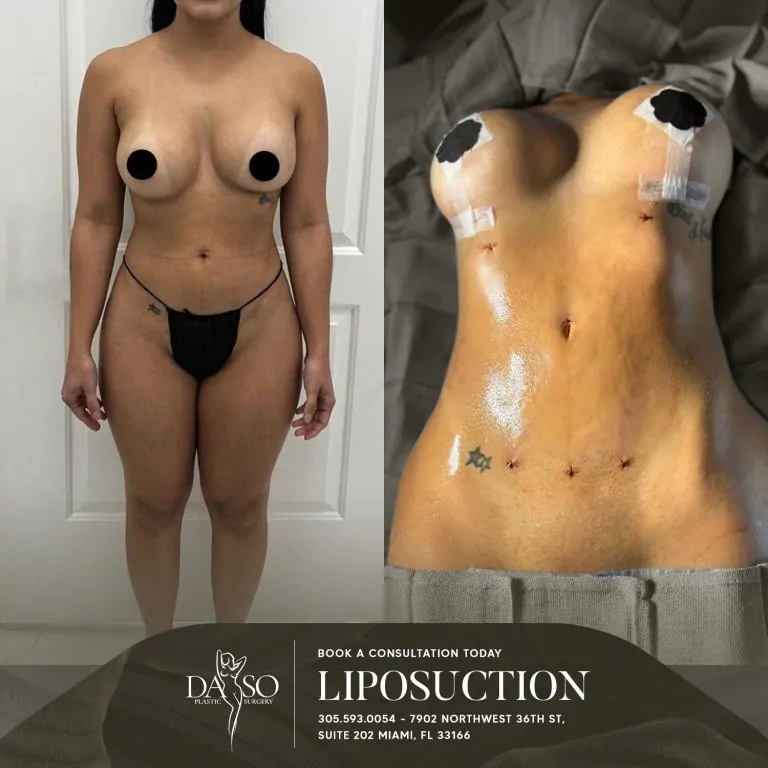 LIPO 3