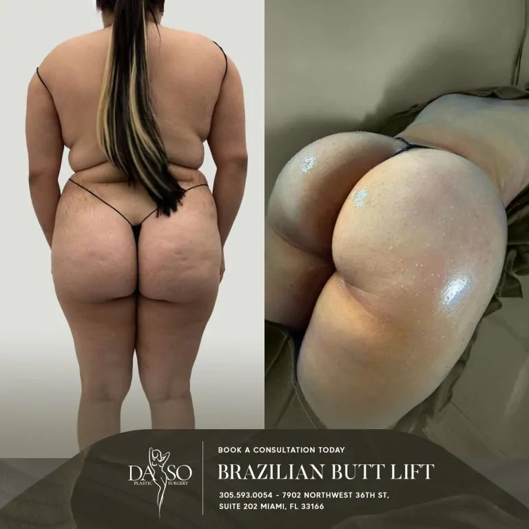 daso plastic surgery